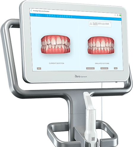 itero scanner thumb1