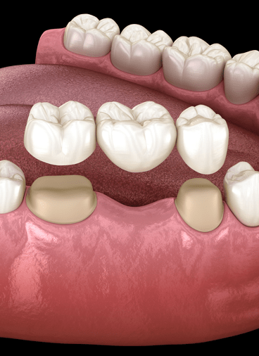 Treatment - hampsteaddental