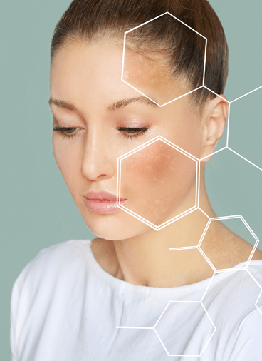 Treatment - hampsteaddental