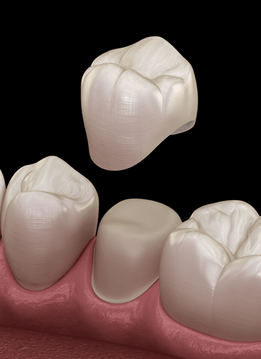 Treatment - hampsteaddental